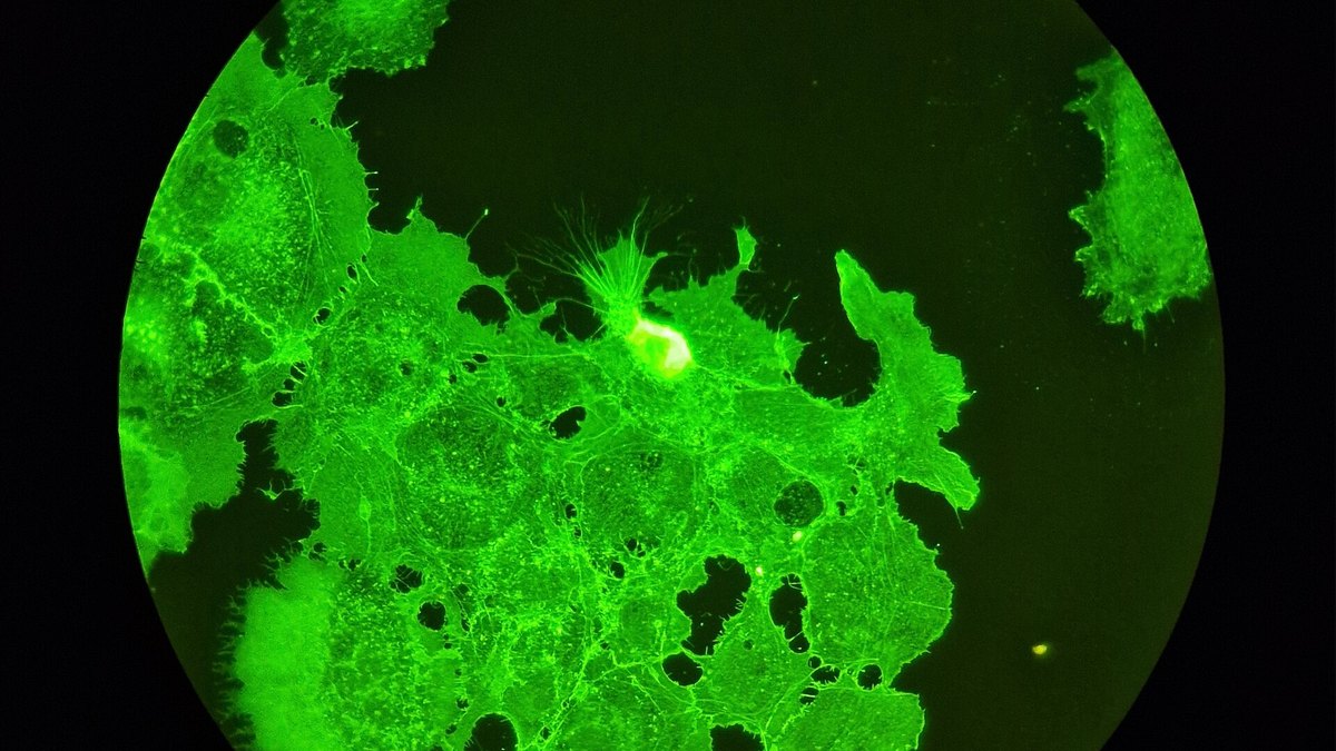 Cultured stem cells under fluorescence microscopy illustrating the Muse cell (Multilineage-differentiating Stress-Enduring) subset — a Panacea Bio Chem science monograph by Bogdan Dicoias